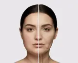 Gespaltenes Gesicht: links jugendlich, rechts gealtert mit Falten. Mögliche Nebenwirkung von Ozempic?