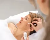 Eine Frau erhält eine Gesichtsbehandlung. Ein Wattestäbchen mit Creme wird auf ihre Wange aufgetragen, um einen dunklen Schatten über der Oberlippe zu behandeln, vielleicht mit einem Hausmittel.