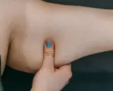 Eine Hand mit blau lackiertem Daumennagel greift in die faltige Haut an einem Arm.