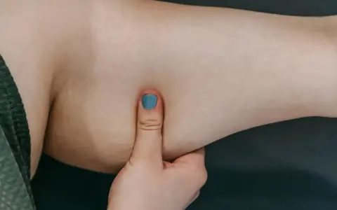 Eine Hand mit blau lackiertem Daumennagel greift in die faltige Haut an einem Arm.