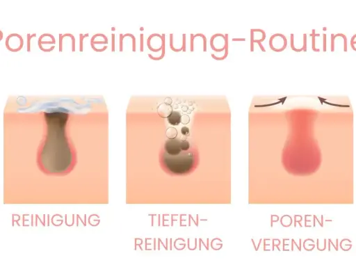 Illustration zeigt die Schritte einer Porenreinigung, wie Mitesser entfernen Hausmittel helfen können, die Poren zu verengen und zu reinigen.