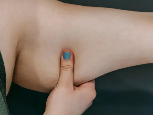 Eine Hand mit blau lackiertem Daumennagel greift in die faltige Haut an einem Arm.