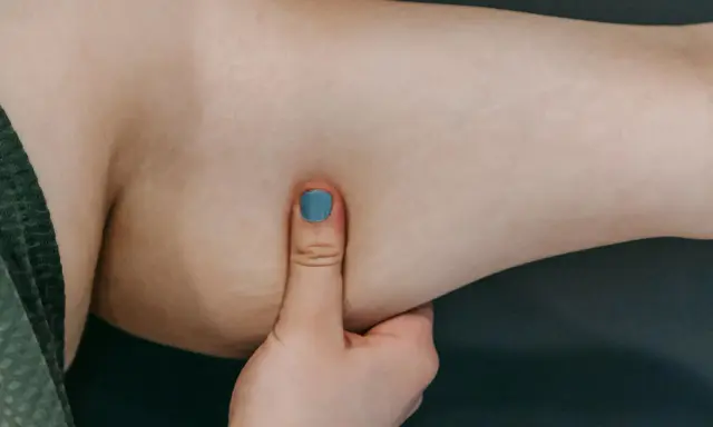 Eine Hand mit blau lackiertem Daumennagel greift in die faltige Haut an einem Arm.